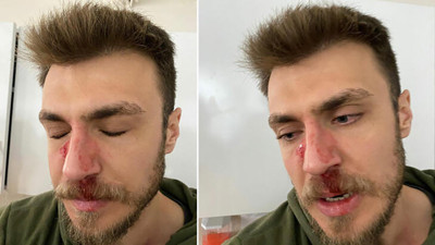 Hasta yakınının saldırısına uğrayan doktor travma geçirmiş