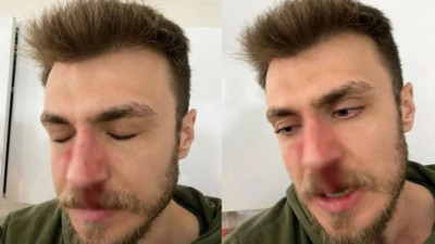 Yeni Akit saldırıya uğrayan doktoru hedef gösterdi. Suriyeli sığınmacı doktora saldırıp burnunu kırmıştı