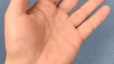 Parmaklarınızla bu hareketleri yapamıyorsanız dikkat. İnme ve Alzheimer riski ile karşı karşıyasınız