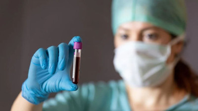 Bu kan grubuna sahip olanlar yandı. Yüzde 82'sinde bunama riski var