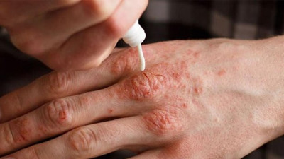 Soğuk havalarda cildi kuruyanları sevindirecek haber