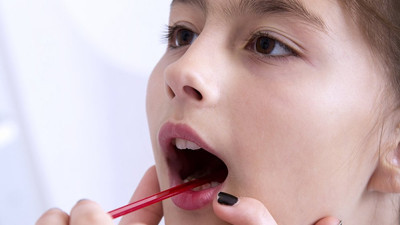 Çocuklarda ağız kokusuna dikkat. Uzmandan ailelere uyarı