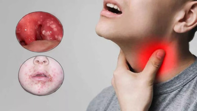 Buna dikkat. Belirtileri varsa hemen doktora koşun