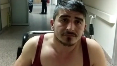 Köpek önce çarptı sonra ısırdı