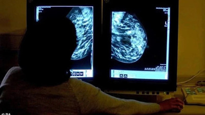 Meme kanserine çare mi bulundu