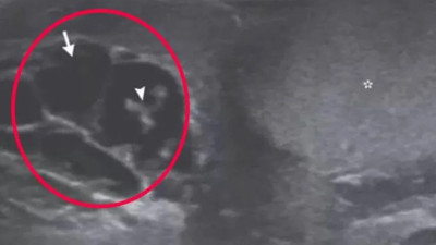 Böyle bir vaka daha önce hiç görülmedi