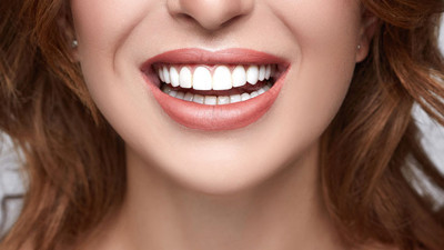 Gülüş estetiği neden yaptırılıyor?