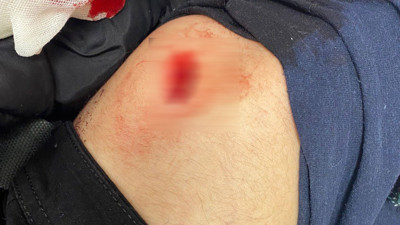 DEVA Partililere bıçaklı saldırı. Yaralılar var