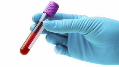 Felaket hastalık karşısında direnci çok zayıf. O kan grubuna sahipseniz aman dikkat