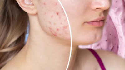 İki haftada vücudunuzda gerçekleşecek değişimlere inanamayacaksınız. Hemen bırakın