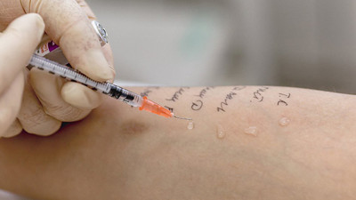 Göğüs Hastalıkları Uzmanından dikkat çeken alerji açıklaması