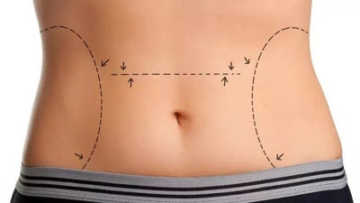 Doğum sonrası estetiği ne zaman ve nasıl olmalı? (21 Aralık 2022)