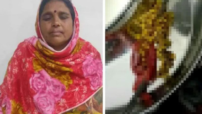 Tam 382 tane çıkarıldı. Doktorlar gözlerine inanamadı