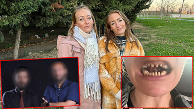 Suriyeliler şimdi de Türkiye’de sağlık turizmini baltalıyor! Açtıkları kaçak klinikte Danimarkalı ikizleri konuşamaz hale getirdiler