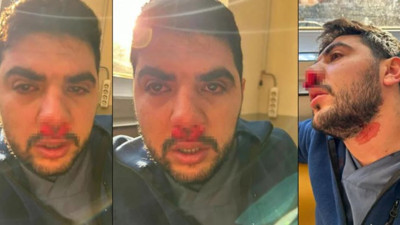 Yer: İstanbul! Hasta yakınından hemşireye yumruklu saldırı