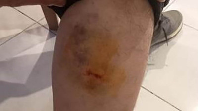 Sahipsiz köpekler yine saldırdı! Bu tehlikeye kim dur diyecek