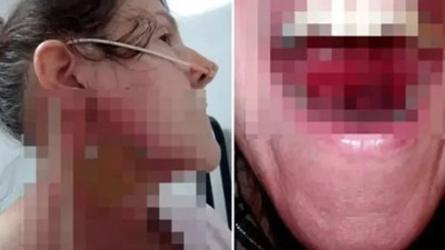 Bademcik iltihabı sandı gerçek bambaşka çıktı. Hayatı kabusa döndü