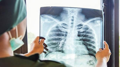 Tedavisi mümkün o hastalıktan 1,6 milyon kişi hayatını kaybetti