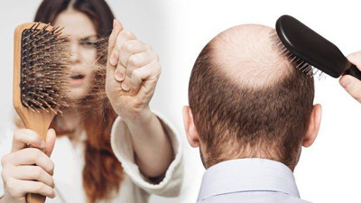 Bilimsel araştırmadan ortaya çıktı. Bütün içecekler kellik riskini artırıyor: Sadece bir tanesi hariç