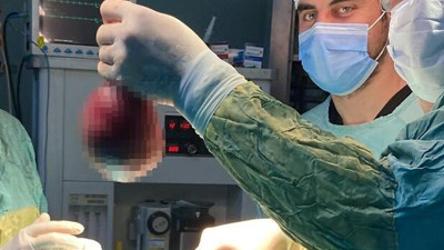 Kadının boynundan çıkan doktorları şaşkına çevirdi
