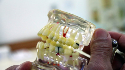 Bu kez sahte diş hekimi vakası. Vatandaşları dolandırdı kayıplara karıştı