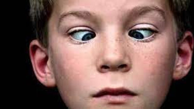 Çocuklarda yalancı şaşılık nedir nasıl anlaşılır?