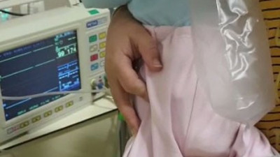 5 aylık ikizlerin mucize kurtuluşu