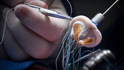 Kalp kapağı tamirinde yeni yöntem