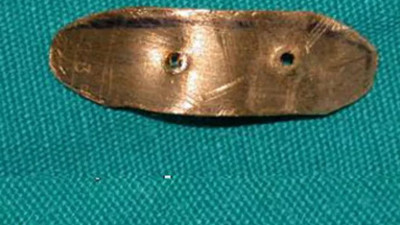 Bu altın vücudun öyle bir yerine takılıyor ki, çok faydalı