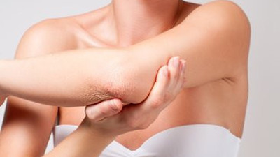 Diz ve dirsekler neden kararır, doğal tedavisi nelerdir?