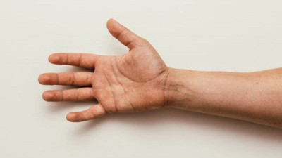 Eldeki renk değişimleri tümör habercisi mi