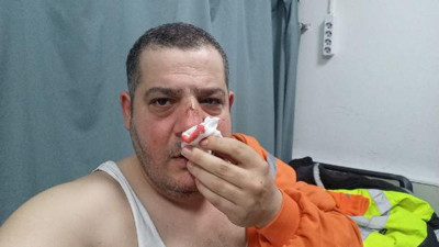 İşitme engelliye eşime baktın dayağı