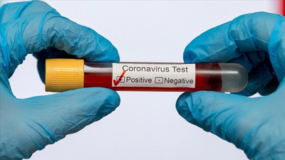 DSÖ: 170 bin insan daha öldü