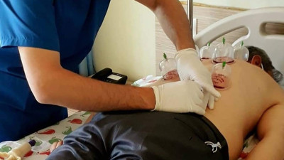 Uzmanlardan ‘hacamat’ uyarısı: Yanlış uygulamalar ömür boyu geçmeyen ağrılar oluşturuyor