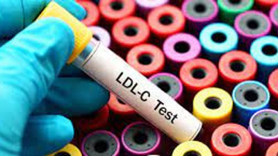 Kötü kolesterolü azaltan 8 yiyecek