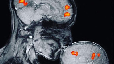 Araştırma sonucu: Sevgi beyinde başlıyor