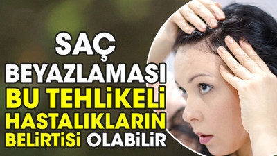 Saç beyazlaması bu tehlikeli hastalıkların belirtisi olabilir