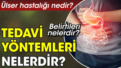 Ülser hastalığı nedir? Ülser hastalığı belirtileri nelerdir? Ülser hastalığı tedavi yöntemleri nelerdir?
