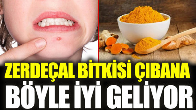 Zerdeçal bitkisi çıbana iyi geliyor