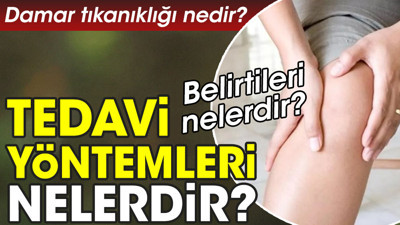 Damar tıkanıklığı nedir? Damar tıkanıklığı belirtileri nelerdir? Tedavi yöntemleri nelerdir?