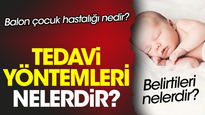 Balon çocuk hastalığı nedir? Belirtileri nelerdir? Tedavi yöntemleri nelerdir?