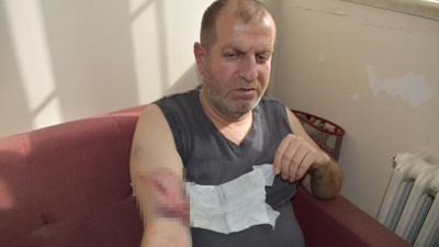 Okul bahçesinde sahipsiz köpeğin saldırdığı öğretmen ile öğrencisi yaralandı