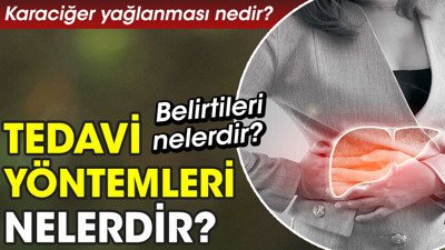 Karaciğer yağlanması nedir? Belirtileri nelerdir? Tedavi yöntemleri nelerdir? (21 Mart 2023)