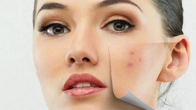 Çıban tedavi yöntemleri nelerdir?