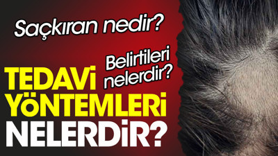 Saçkıran nedir? Saçkıran belirtileri nelerdir? Saçkıran tedavi yöntemleri nelerdir?