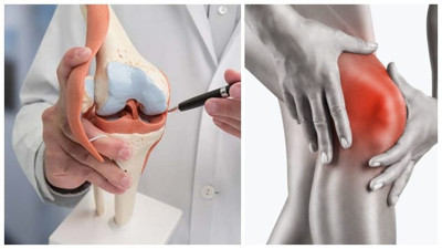 Hangi ağrılar Menisküs belirtileridir