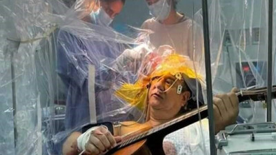 Beyin ameliyatı olurken 4 saat boyunca gitar çaldı