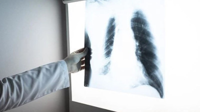 '2021 yılında yaklaşık 10,6 milyon yeni hasta ortaya çıktı'