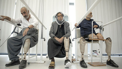 13 bin 593 mayın mağduru tedavi görüyor (05 Nisan 2023)