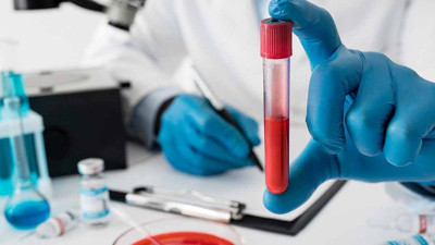 Anemiye iyi gelen 10 besin